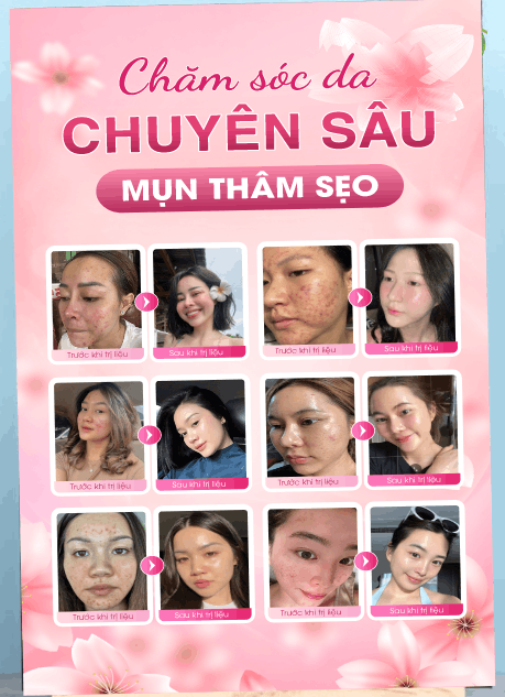 18387 cham soc da chuyen sau mun tham seo 2.png