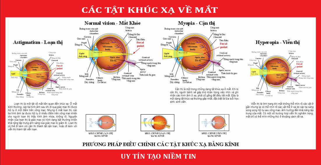 18826 cac tat khuc xa ve mat.png