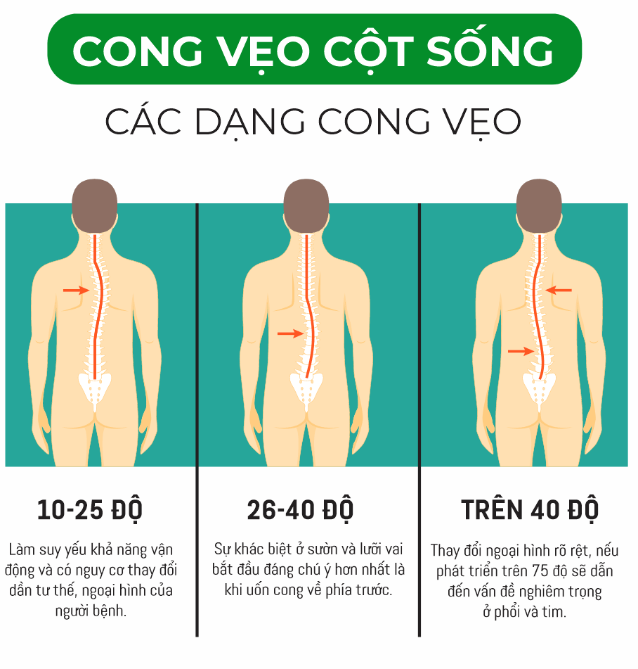 272 demo poster kien thuc ve xuong gym 8.png
