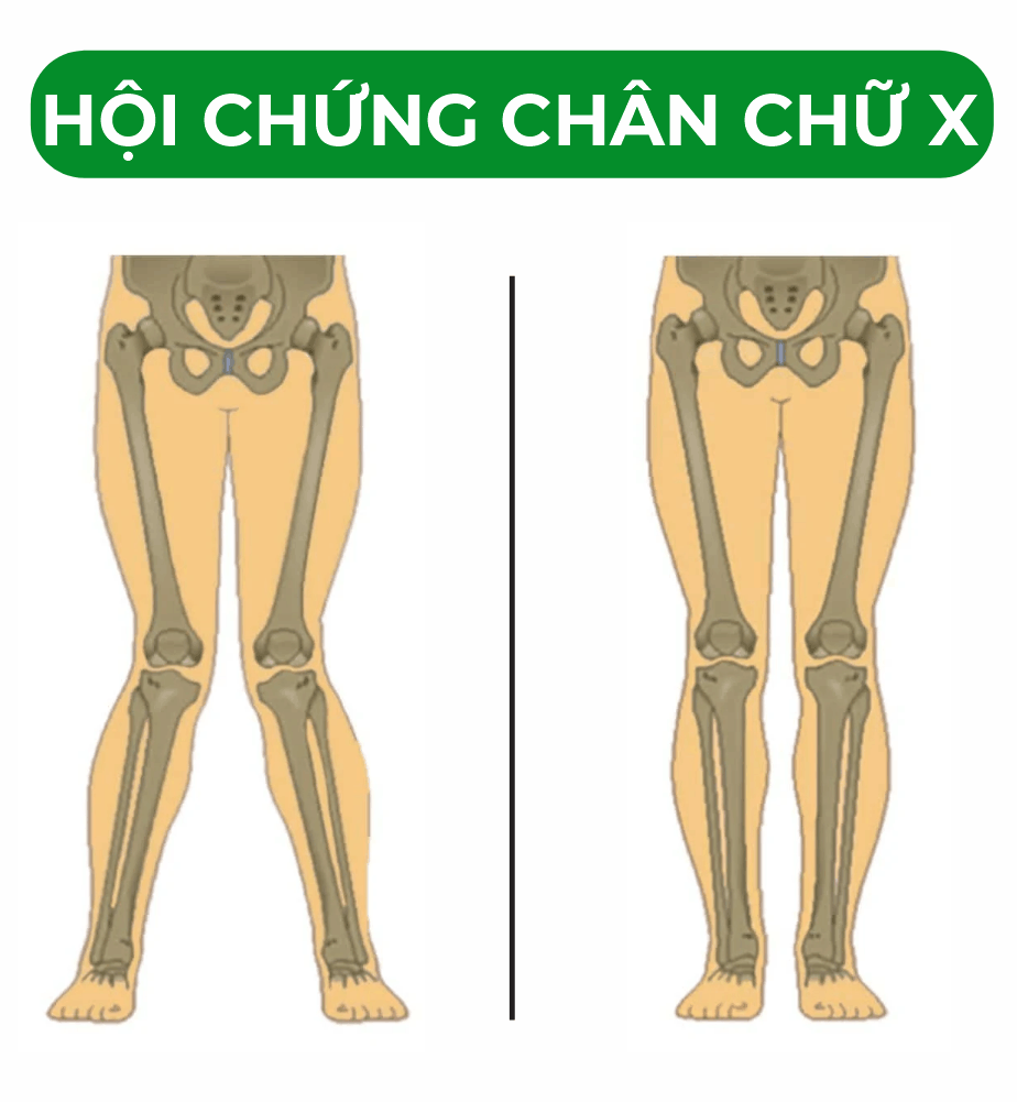 272 demo poster kien thuc ve xuong gym 9.png
