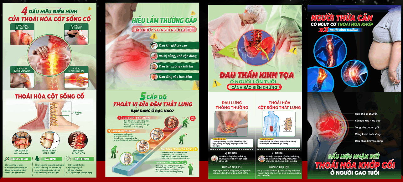 Poster về cột sống cổ - thoái hóa khớp file cdr